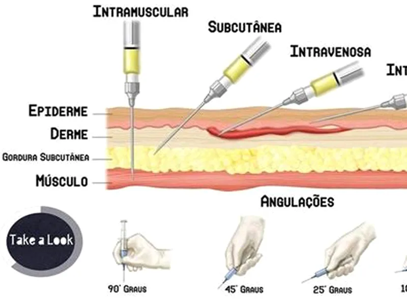 Aplicação subcutânea do Ozempic no abdômen